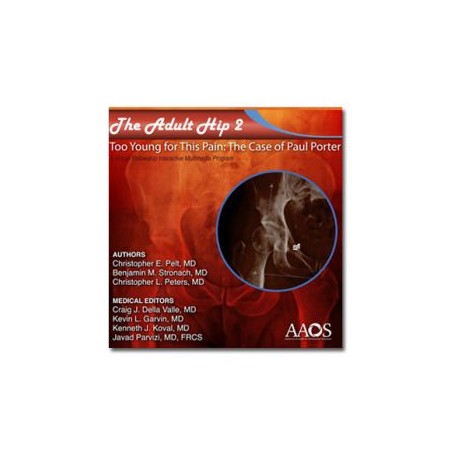 CD-ROM The Adult Hip 2 Too young for this pain