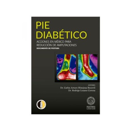 Pie diabético. Acciones en México para reducción de amputaciones (Intersistemas)