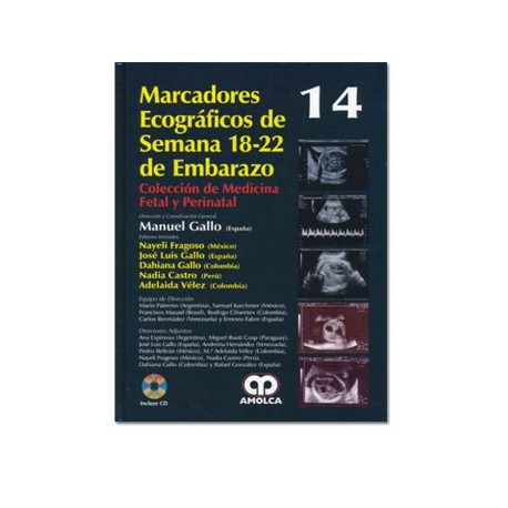 Marcadores ecográficos de la semana 18-22 de embarazo (Amolca)