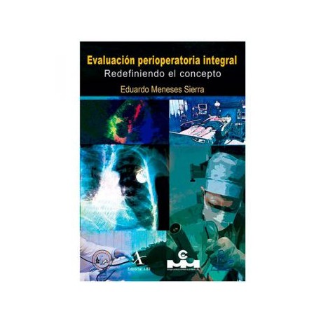 Evaluación perioperatoria integral. Redefiniendo el concepto (Alfil)