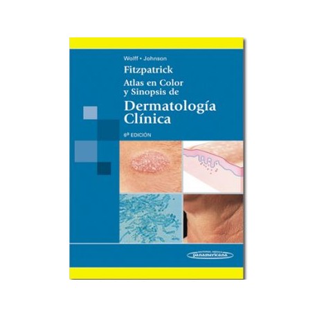 Fitzpatrick. Atlas en color y sinopsis de Dermatología Clínica