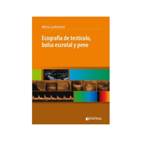 Ecografía de Testículo, Bolsa Escrotal y Pene (Journal)