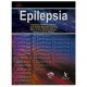 Epilepsia
