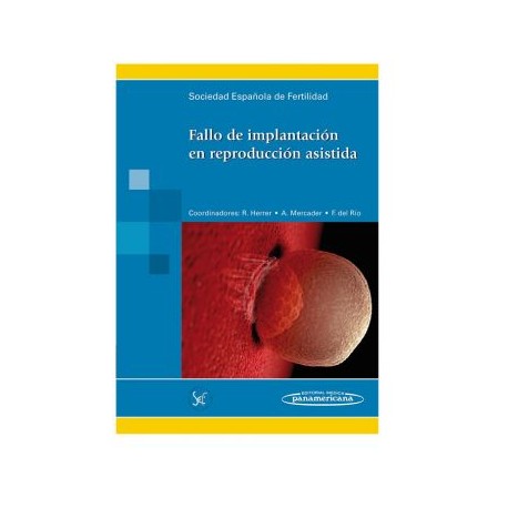 Fallo de implantación en reproduccion asistida (Panamericana)