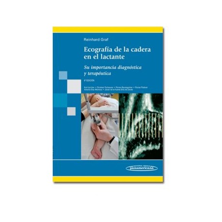 Ecografía de la cadera en el lactante (Panamericana)
